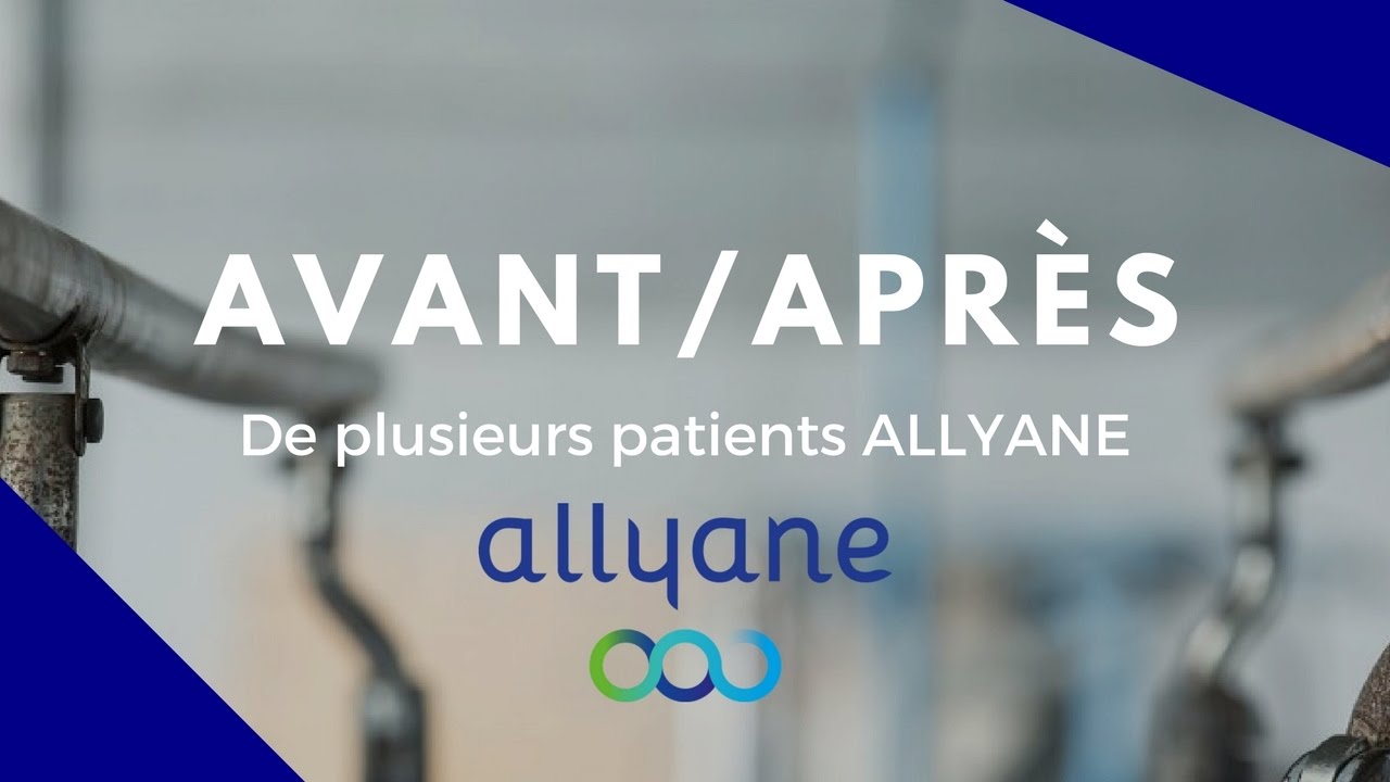 Démonstrations des résultats de la méthode Allyane