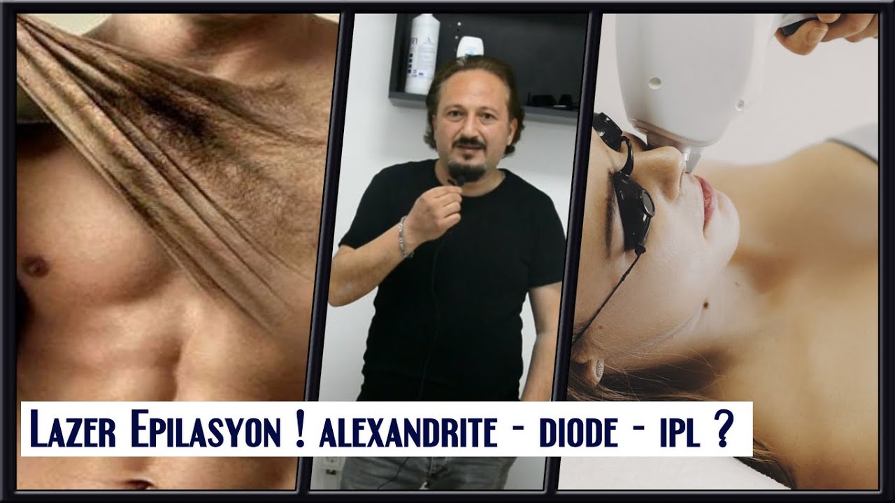 Alexandrite - Diode - IPL  Lazer Epilasyon Uygulaması Hakkında Doğru Bilinen Yanlışlar!