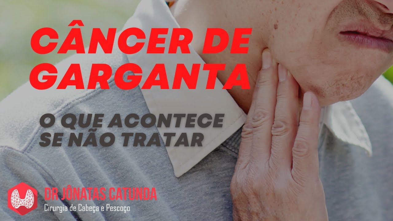 Câncer de garganta sem tratamento, qual a sobrevida?