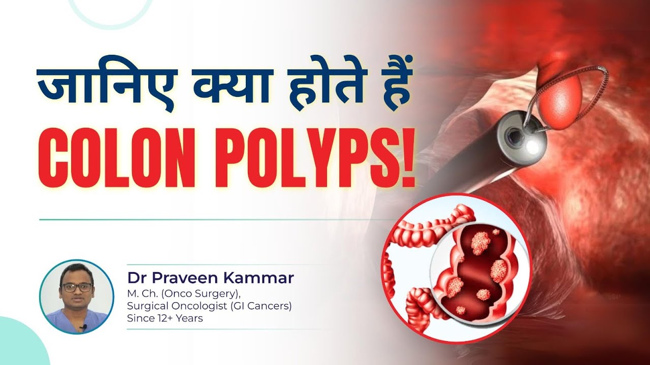 जानिए क्या होते हैं Colon Polyps! | Colon Polyps Explained | Are They a Sign of Cancer? | Dr Praveen