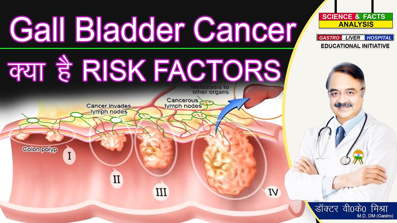GALL BLADDER CANCER क्या है RISK FACTORS || GALL BLADDER CANCER