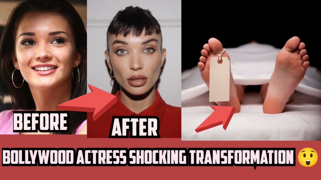 Bollywood Actresses Plastic Surgery | Before vs After देखकर आप भी हैरान रह जाएंगे। #Bollywood 