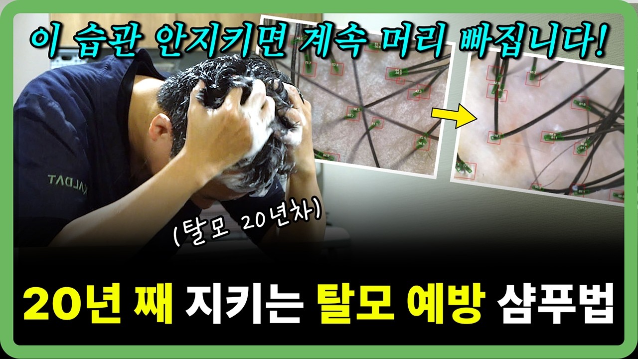 탈모의사가 직접 낋여온 샴푸법과 드라이