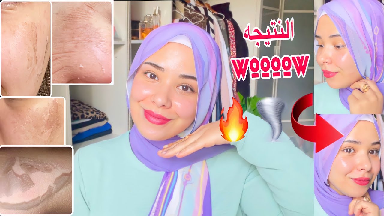 اقوي وانجح تقشير كميائي للوجه والجسم,حل سحري لاي اسمرار عندك من سنين#4k