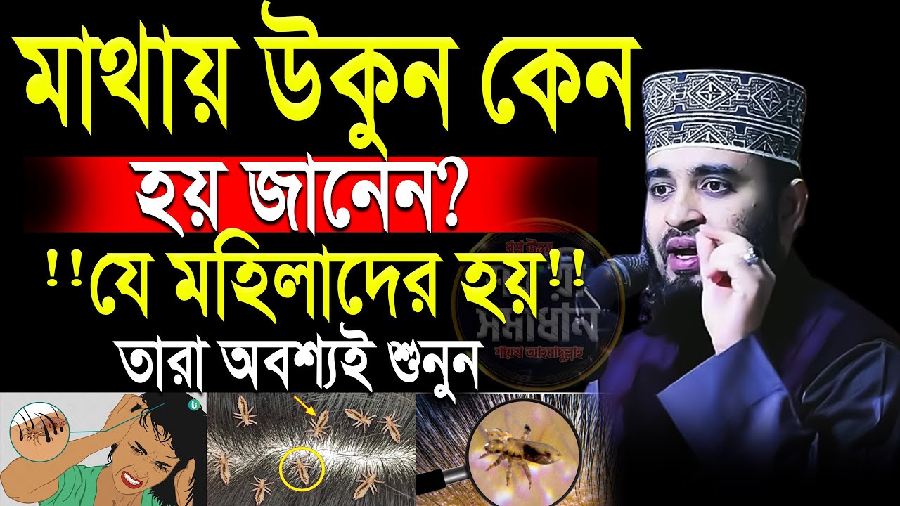 যে মহিলাদের মাথায় উকুন হয় তারা গোপন তথ্যগুলো জানুন💓mizanur rahman azhari-ep=18 Jan 20 2026 2:55 PM