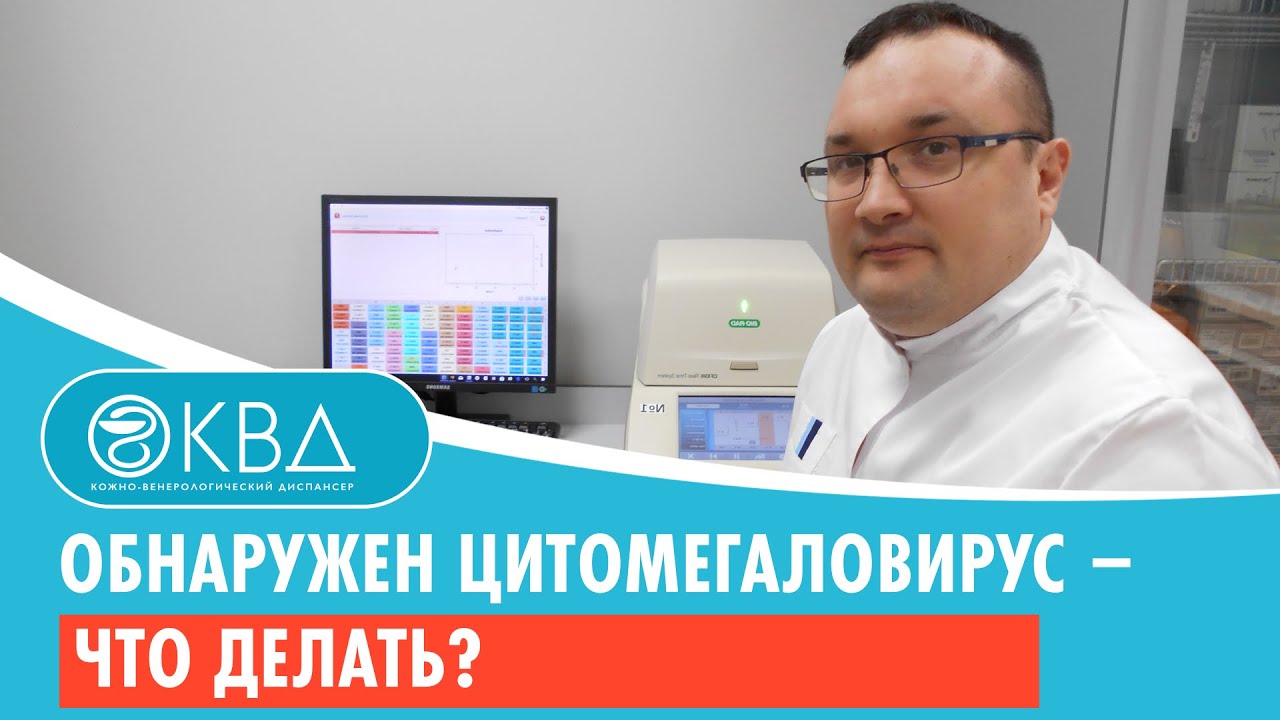 Обнаружен цитомегаловирус – что делать?