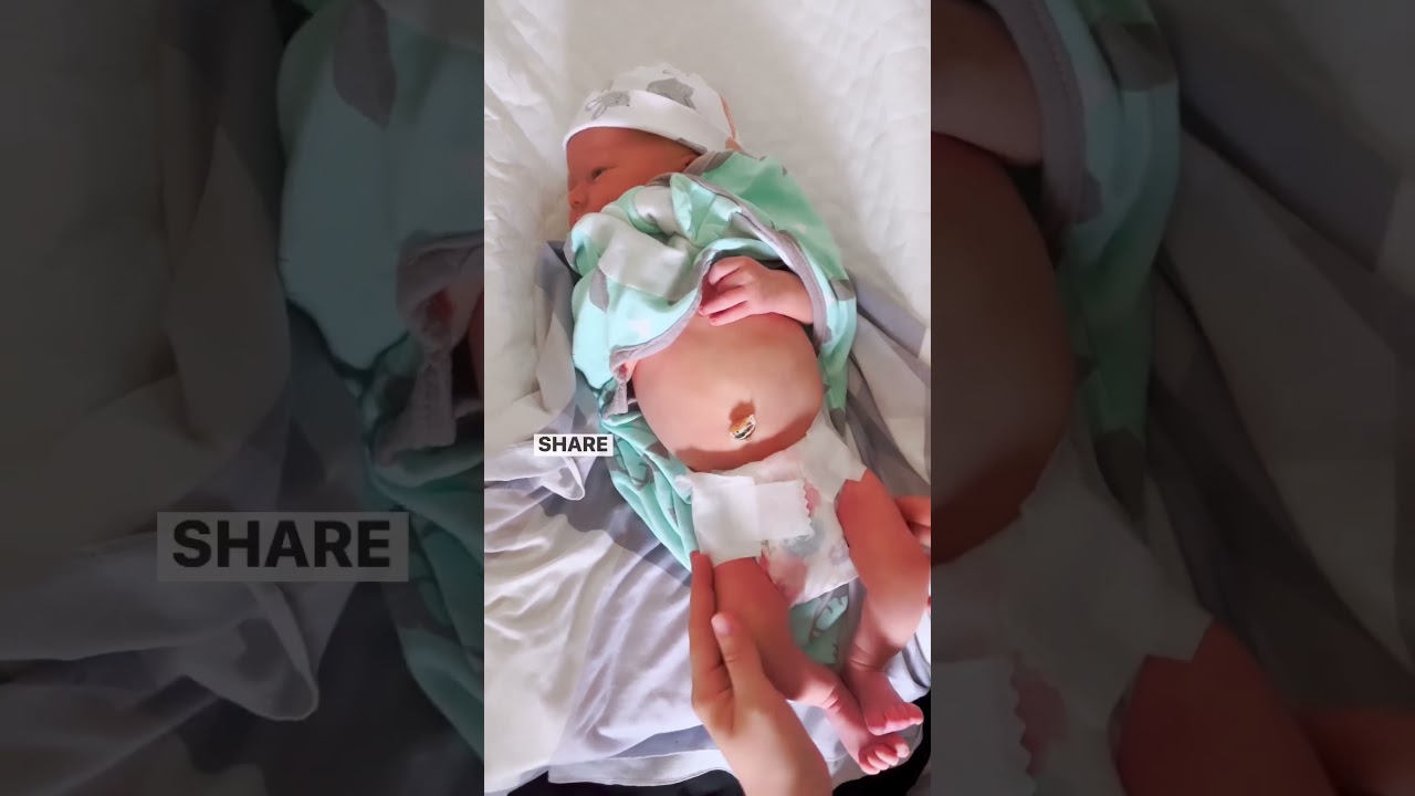 Советы по выбору подгузников для новорождённых! Поделитесь со всеми, кто ждёт малыша 🤍
