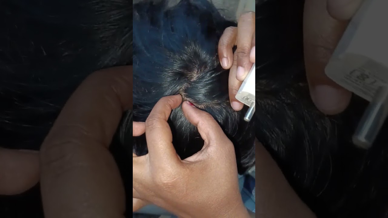 #asmr checking nits