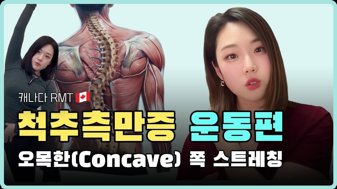 척추측만증, 이 영상 하나면 끝! 수술?치료? 운동 으로도 충분히 가능! 척추측만증 운동편
