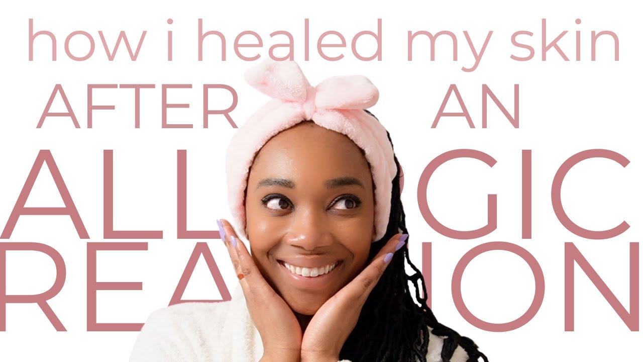 the easiest way to clear your skin after an allergic reaction