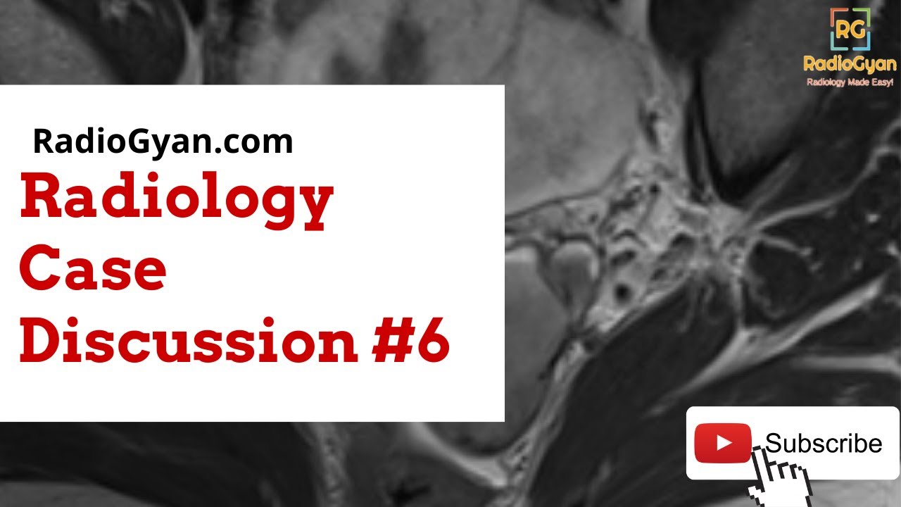 Endometriosis - Imaging approach (Case-based Approach) | Radiology Board Review Case