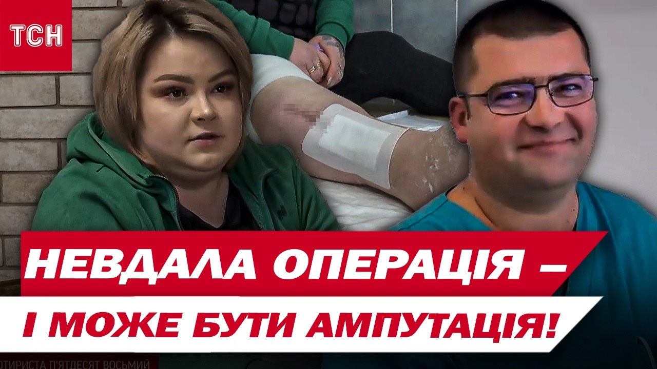 Медичний скандал! Пацієнтці після планової операції загрожує ампутація ноги!