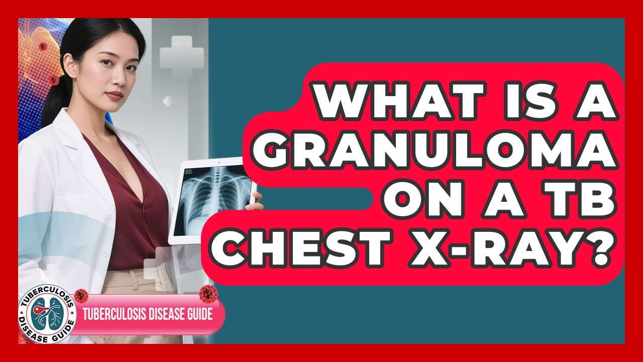 What Is A Granuloma On A TB Chest X-ray? - Tuberculosis Disease Guide