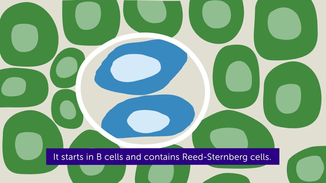 What is Lymphoma? | Cancer Research UK | 2022
