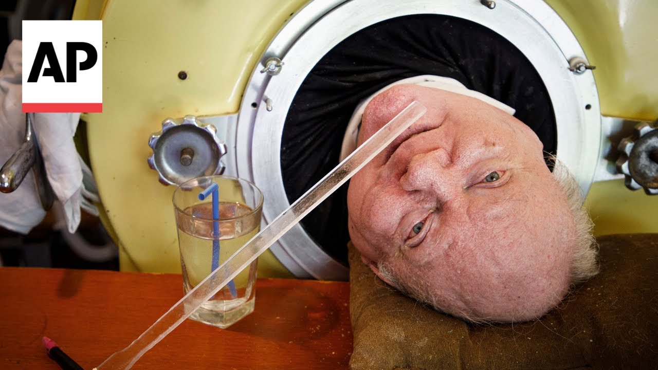 Iron lung user Paul Alexander dies at 78