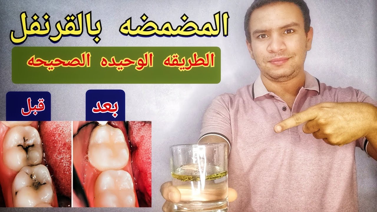 ماذا يحدث اذا قمت بالمضمضه بالقرنفل يوميا لمده ٢١ يوم