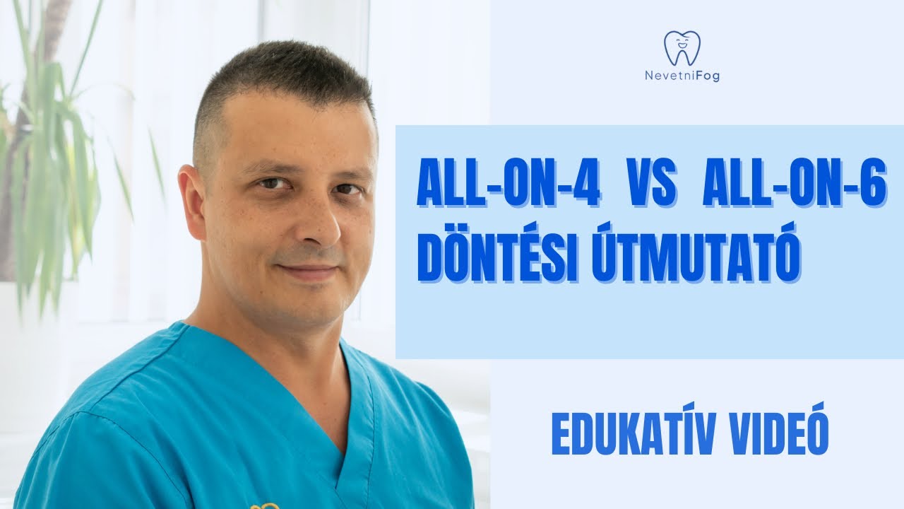 All-on-4 vs All-on-6 | Döntési Útmutató | Dr.Kovács Roland