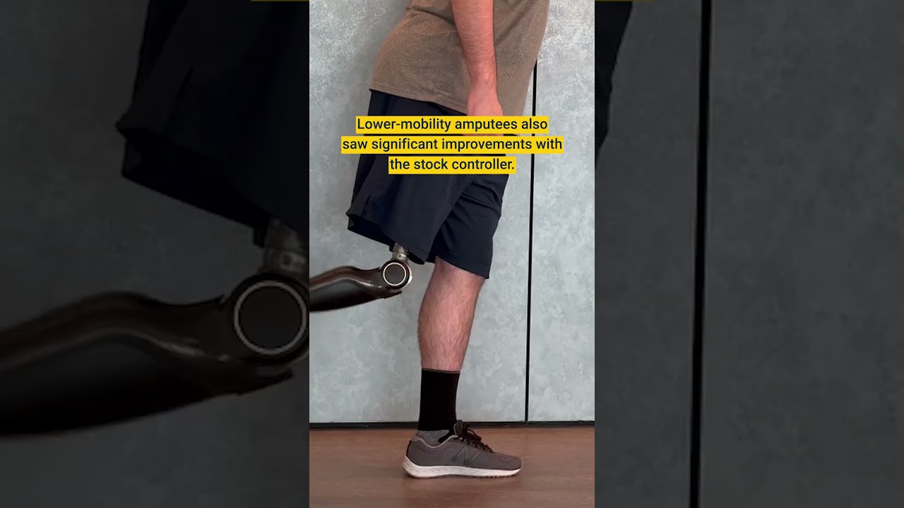 This AI-Powered Knee is Rewriting What's Possible for Amputees