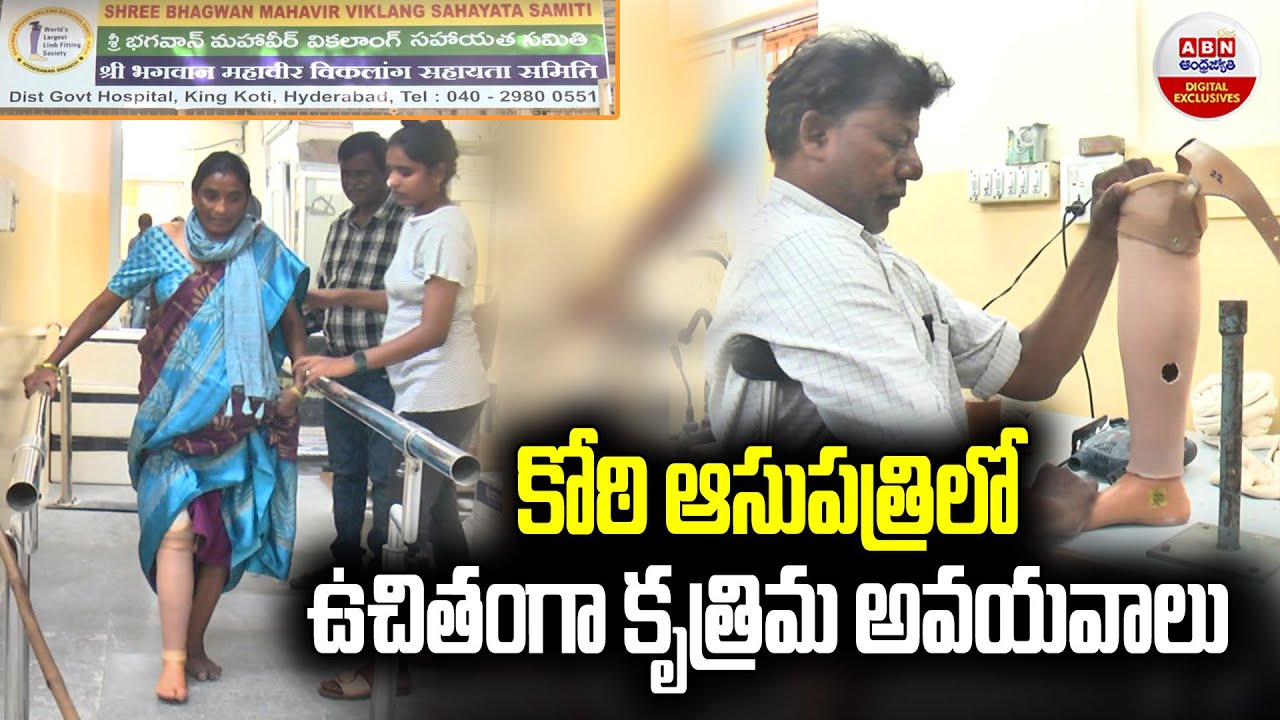 Free Artificial Limbs at Koti Govt Hospital : కోఠి ఆసుపత్రిలో ఉచితంగా కృత్రిమ అవయవాలు | ABN Digital