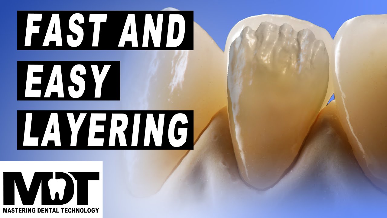 Discover the Fast and Easy e.max and Zirconia micro layering method [ Quick And Great Results ]