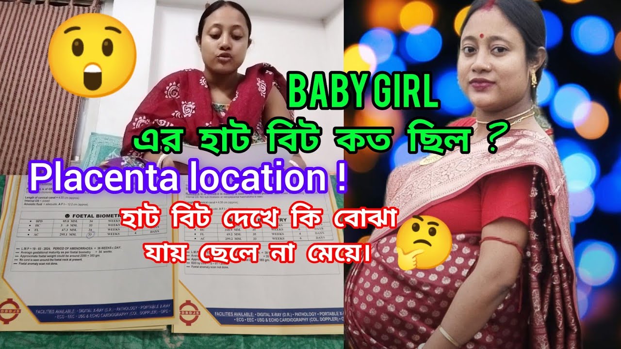placenta  location/আমার বাচ্চার হাট বিট কত ছিল?হাট বিট 140 এর নিচে থাকলে কি ছেলে হয় 🤔