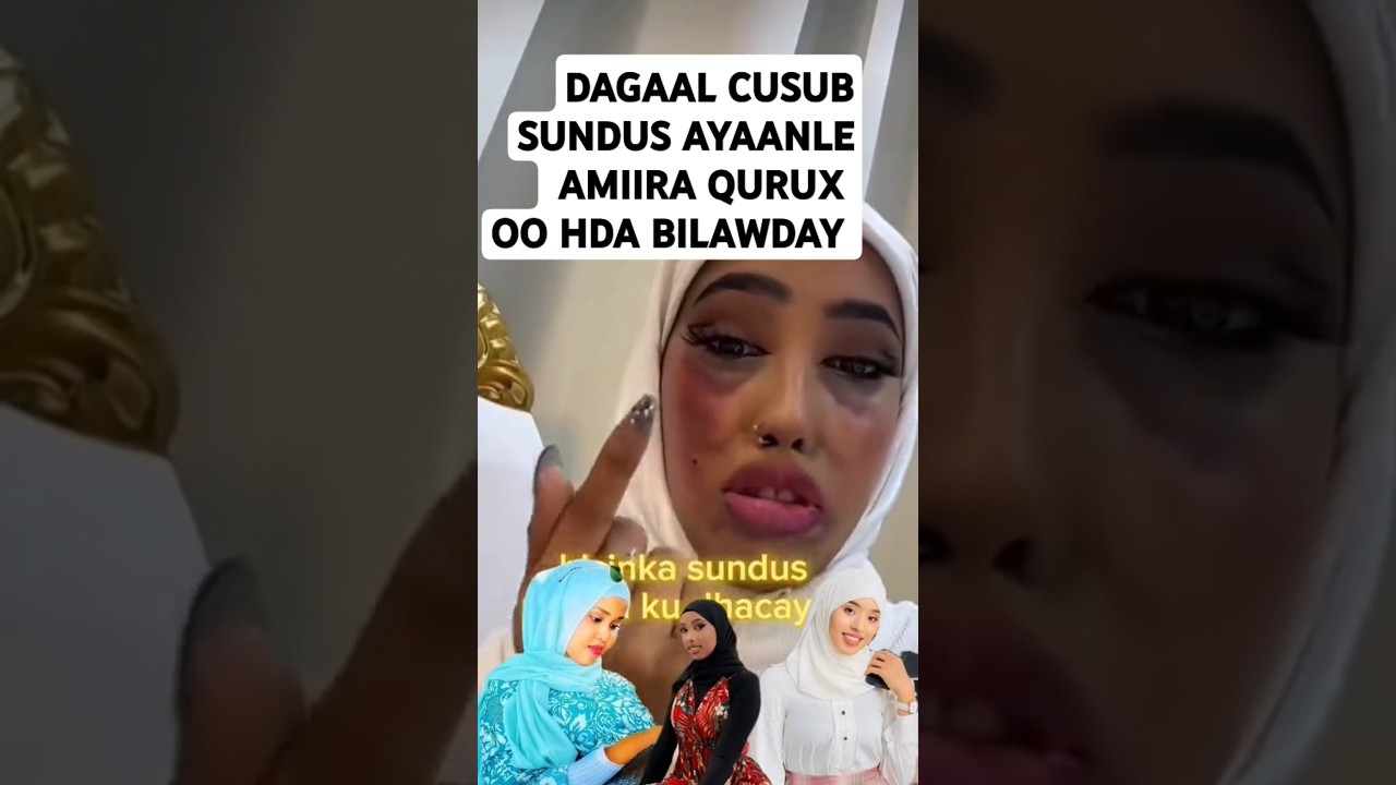 MA RUNBA ASXAPEY DAGAAL KAAN OO HDA LA SHEEGAYO SUNDUS AYAANLE