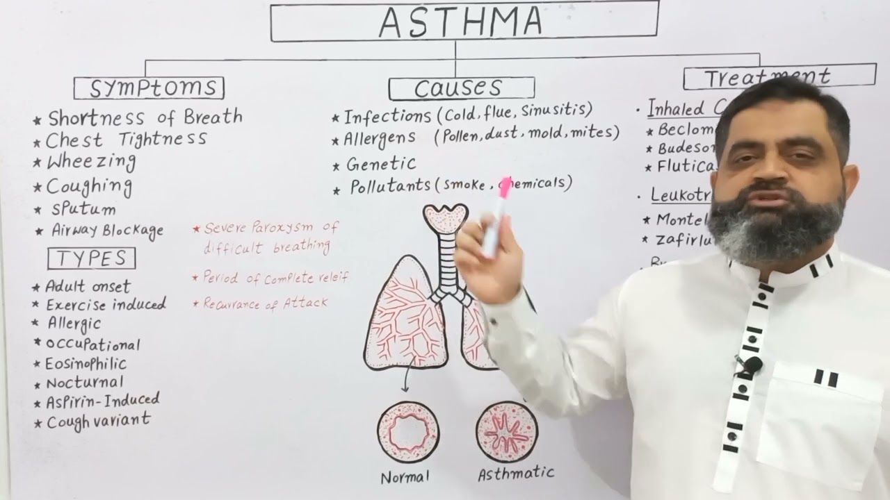 Asthma Urdu/Hindi medium @Prof. Masood Fuzail| Types of Asthma | Exercise induced Asthma | Allergy