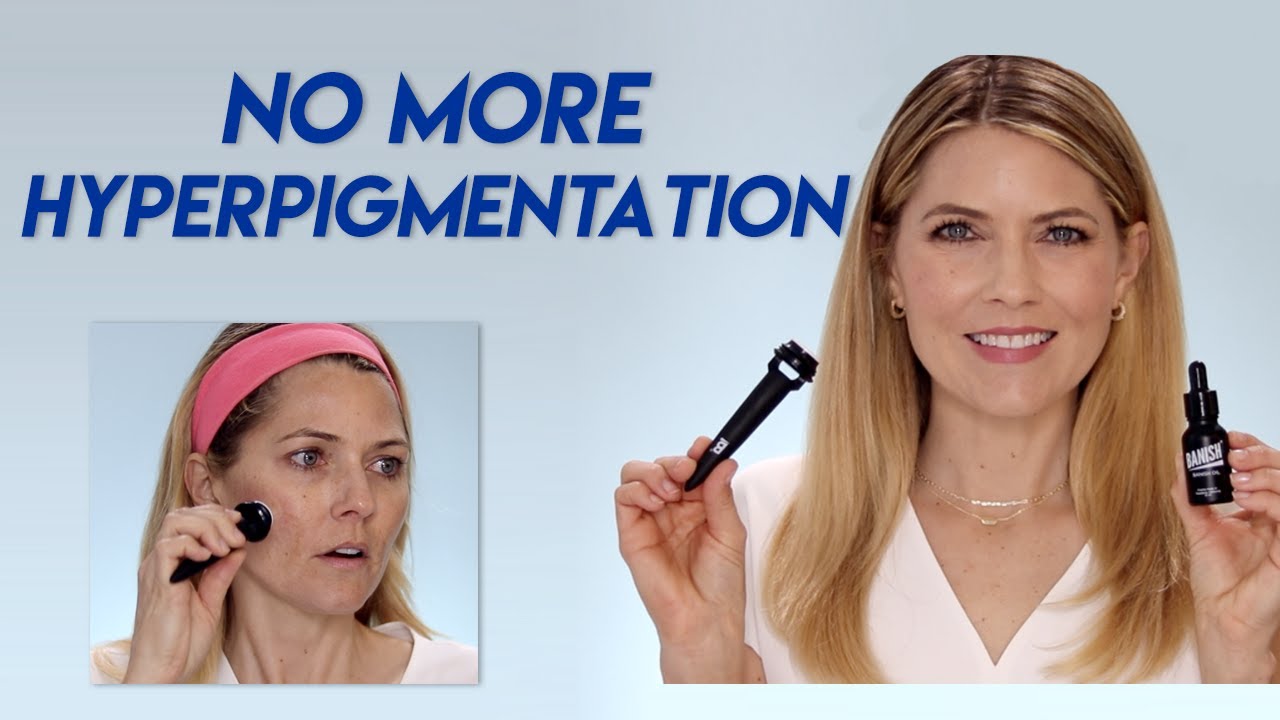 Stamp Away Hyperpigmentation and Acne Scars with The Banisher Microneedling Tool