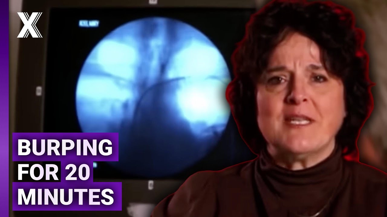 Burping 20 Minutes Nonstop Her Mystery Illness | Mystery Diagnosis