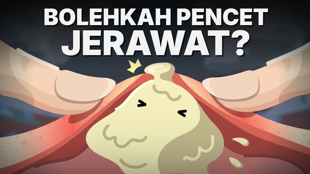 Apa yang Terjadi Saat Jerawat Dipencet?
