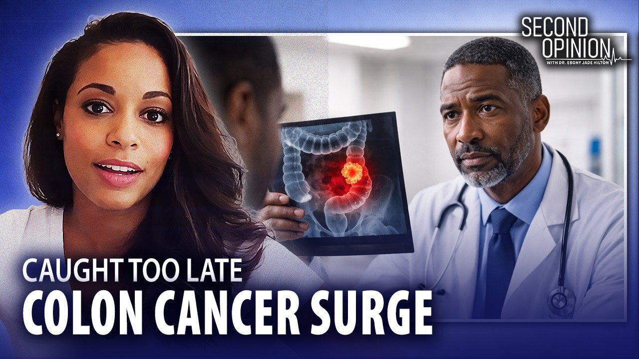 Colon Cancer Is Exploding Under 50. Doctors Warn It’s Being Caught Too Late.