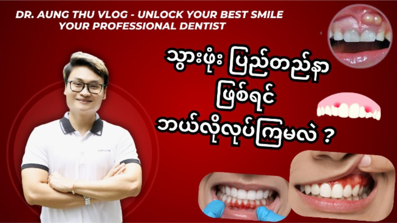 သွားဖုံး ပြည်တည်နာ ဖြစ်ရင် ဘယ်လိုလုပ်ကြမလဲ ?
