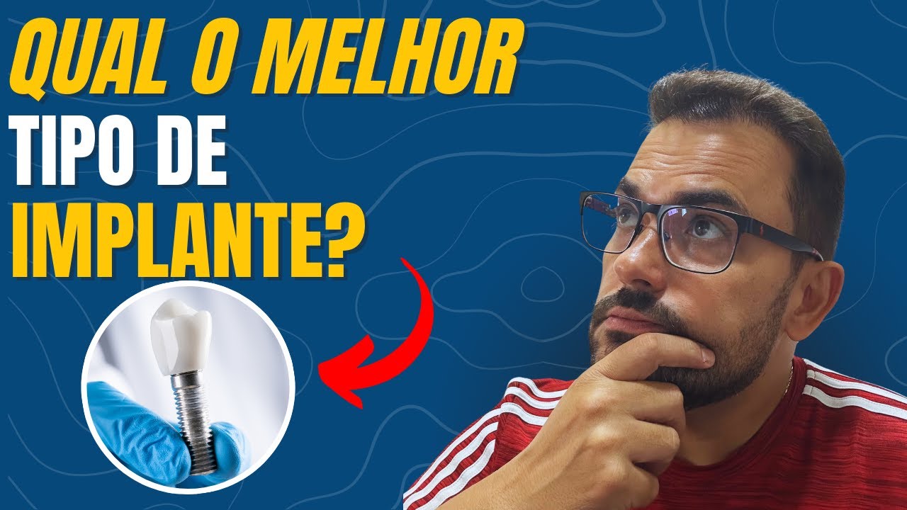 QUAL IMPLANTE DENTÁRIO ESCOLHER?