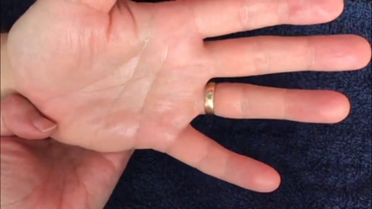 When Nail Cutting is Difficult: How to Overcome Sensory Problems