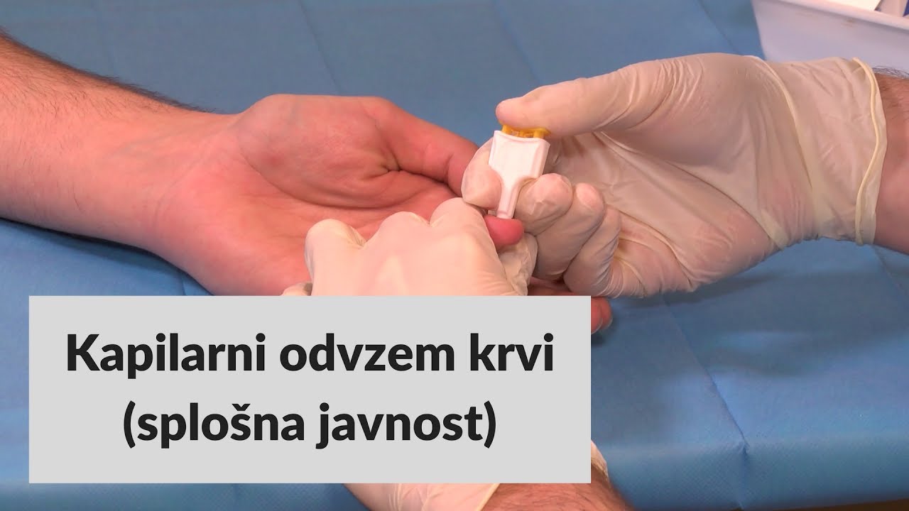 Kapilarni odvzem krvi - splo&scaron;na javnost