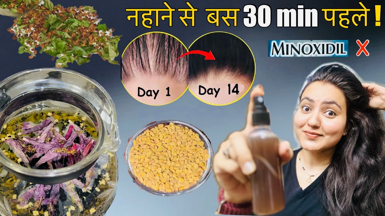14 Days Challenge : Hair Wash से 30 मिनट पहले USE करें,100% Hair Fall बंद DENSITY & VOLUME दो गुना💕