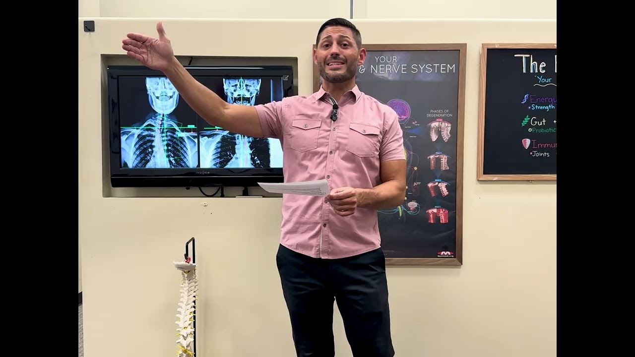 Why X Ray + Havvic