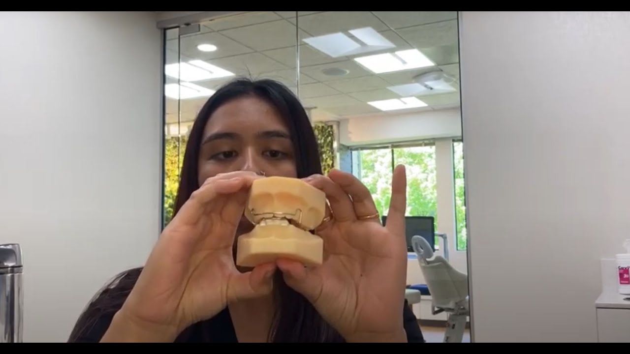 How to Care For and Maintain Your Orthodontic Bionator