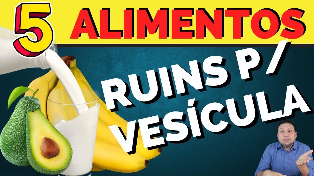5 ALIMENTOS RUINS PARA PEDRA NA VESÍCULA