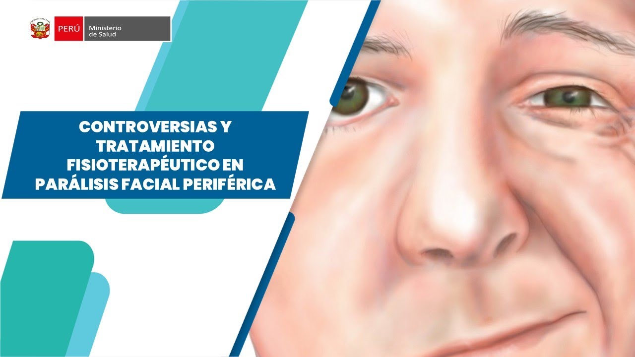CONTROVERSIAS Y TRATAMIENTO FISIOTERAPÉUTICO EN PARÁLISIS FACIAL PERIFÉRICA