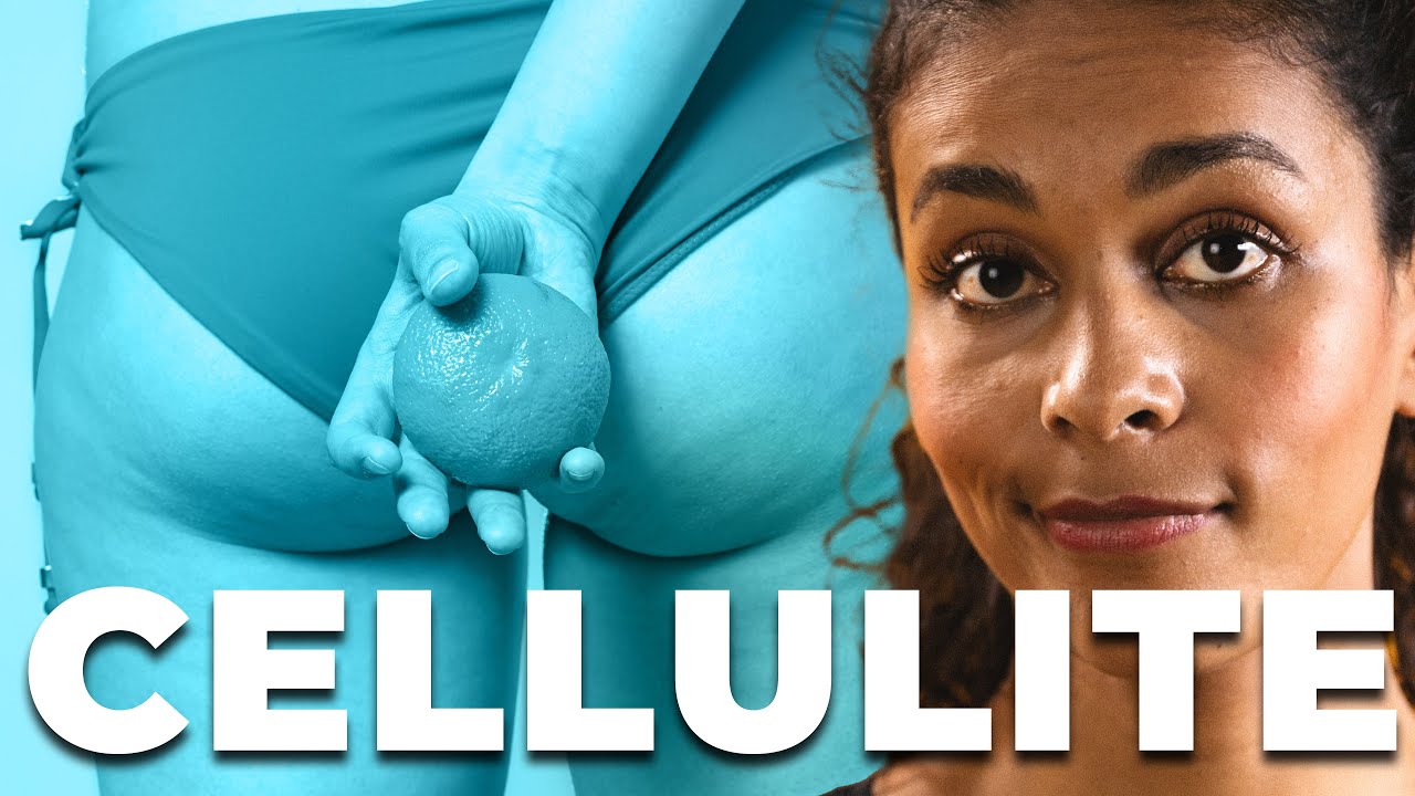 CELLULITE loswerden - DAS hilft!