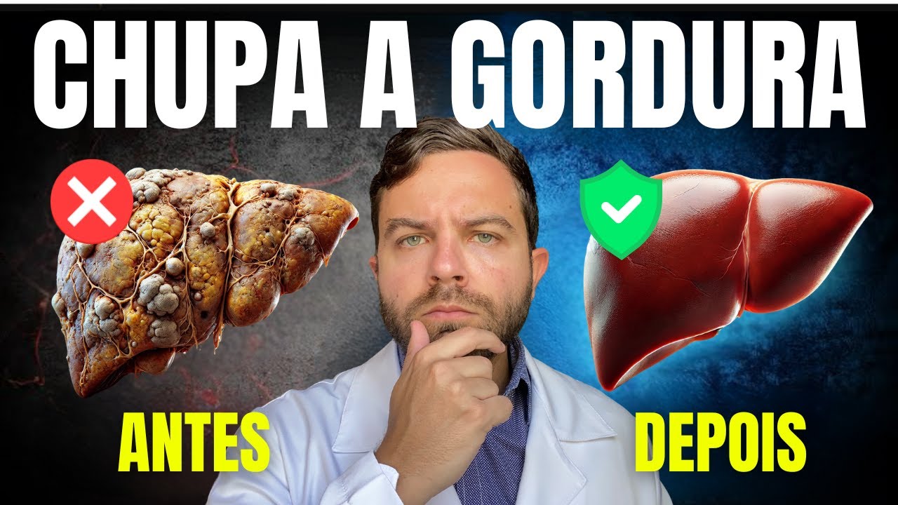 7 CHÁS INCRÍVEIS para CHUPAR GORDURA do FÍGADO | Tratamento Caseiro de ESTEATOSE HEPÁTICA