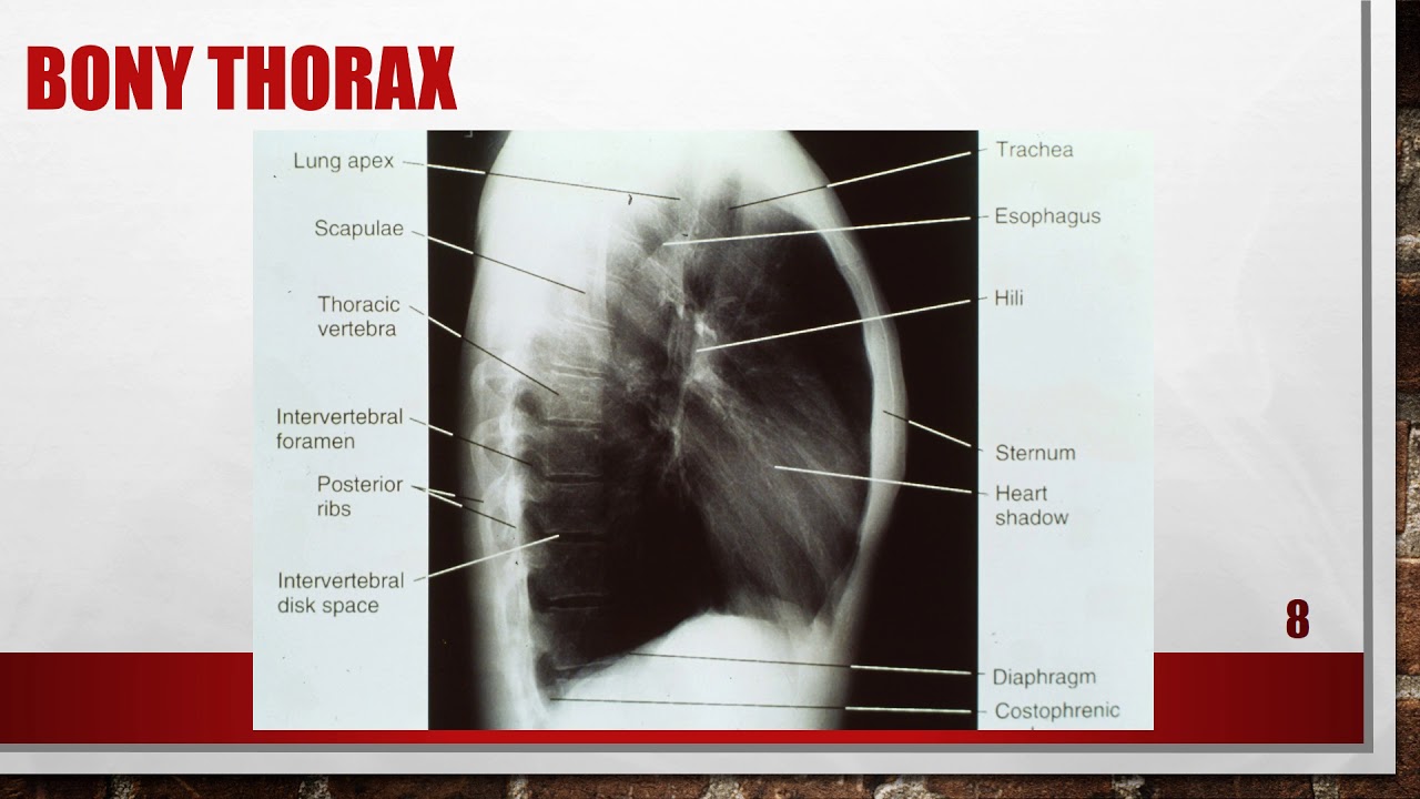 Radiographic Chest Image Critique
