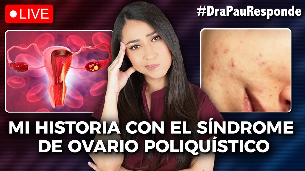 Mi historia con el síndrome de ovario poliquístico👩🏻‍⚕️ #DraPauResponde