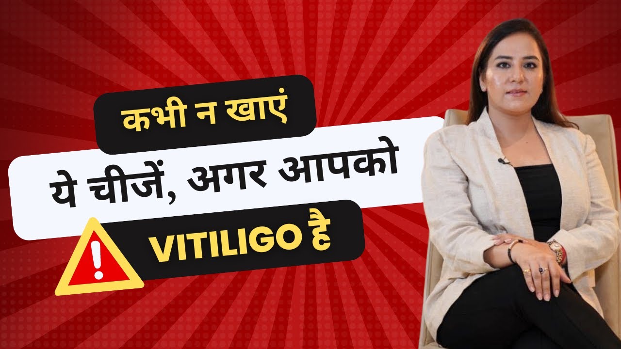 NEVER EAT THESE FOODS | Vitiligo Special | Dr. Nitika Kohli