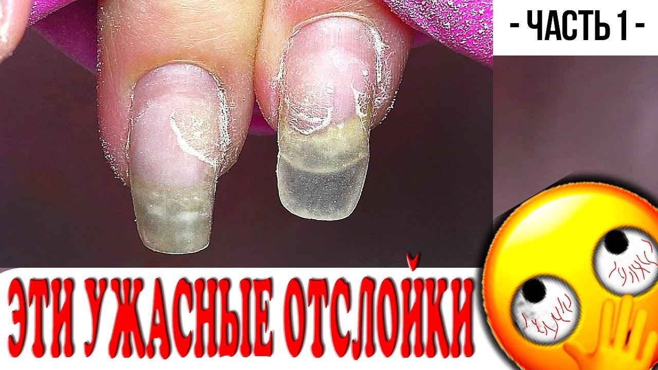 Эти Ужасные Отслойки/ Маникюр Виктория Авдеева/ Часть 1