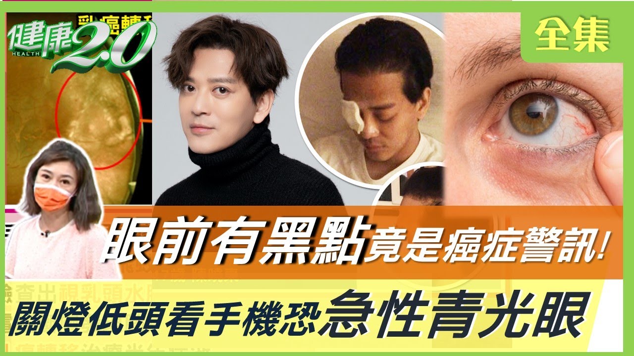 陳曉東 關燈滑手機竟 青光眼 險失明！眼前有黑點 竟是癌症警訊？ 飛蚊症恐視網膜剝離 五行護眼降眼壓！ 健康2.0 20221119【完整版】 鄭凱云 陳瑩山 林友祺 張宏銘 張宏銘 芳瑜