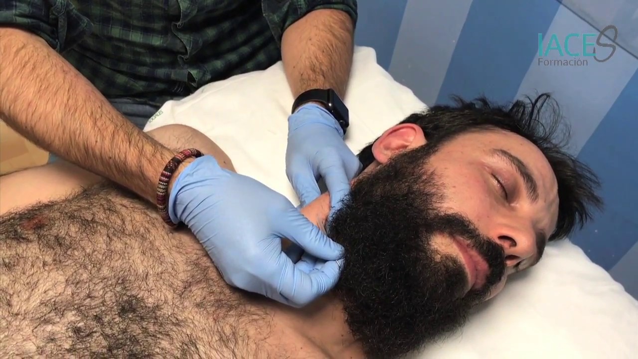 TÉCNICA DE PUNCIÓN EN EL ESTERNOCLEIDOMASTOIDEO