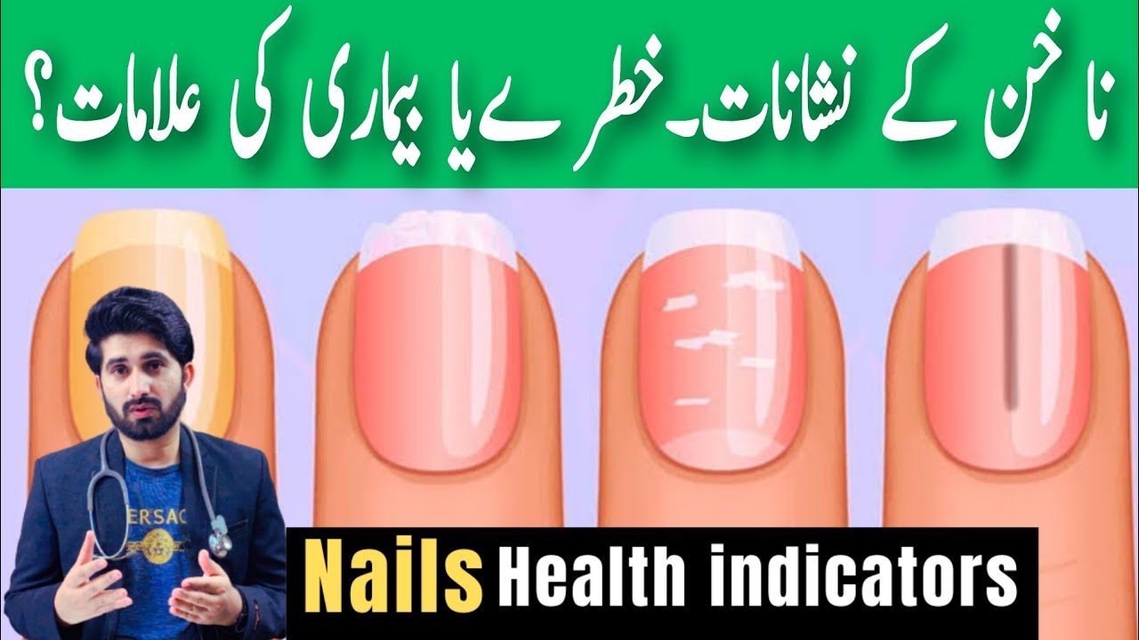What do Your Nails Say About Your Health & Nutrition? (Hindi/urdu)//Nakhun aur amraz