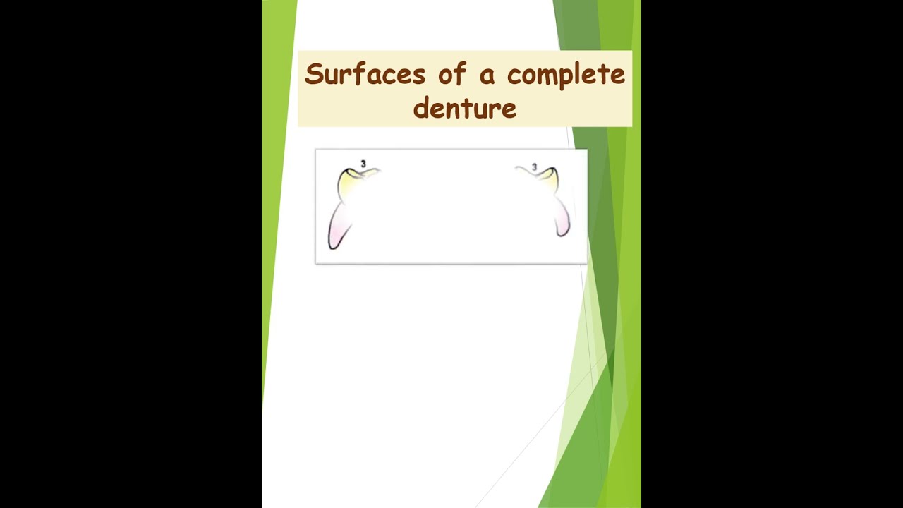 Surfaces of a complete denture #draaryasvlogs #dentistry
